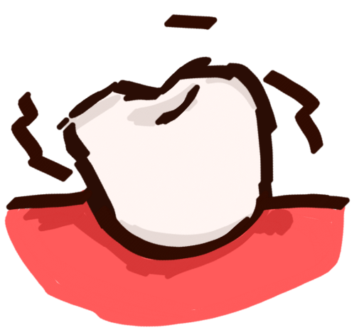 a tooth tilted to the left in pink gums with wobbly lines around it